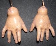 Hands Restored Hands Restored